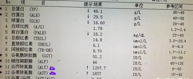 乙肝携带者和乙肝大三阳有什么区别图3